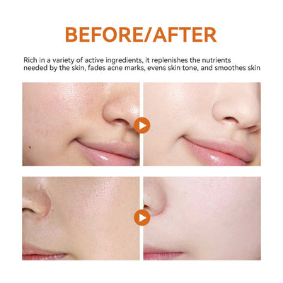 Turmeric Facial Mask Xyrose — Brillo dorado con ciencia y tradición